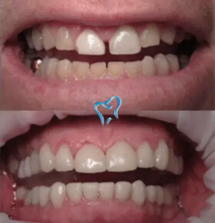 Patient case 1
