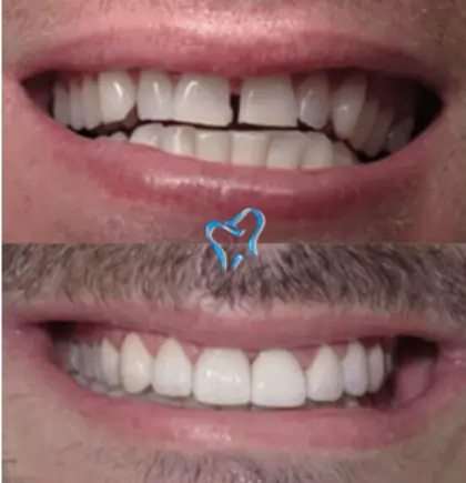 Patient case 2