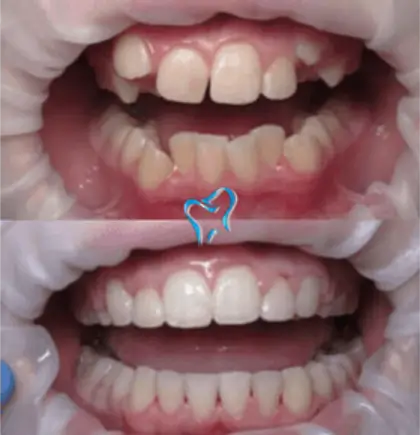 Patient case 3