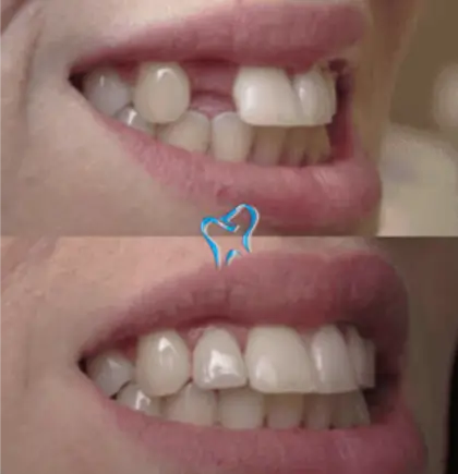 Patient case 4