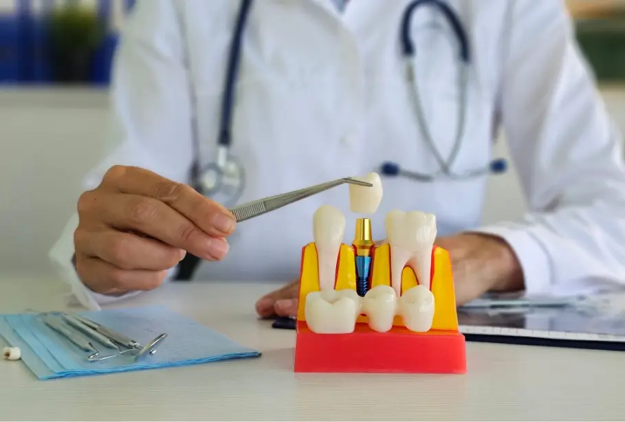 Dental Implant Consultation