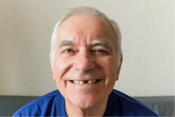 I Have Missing Teeth