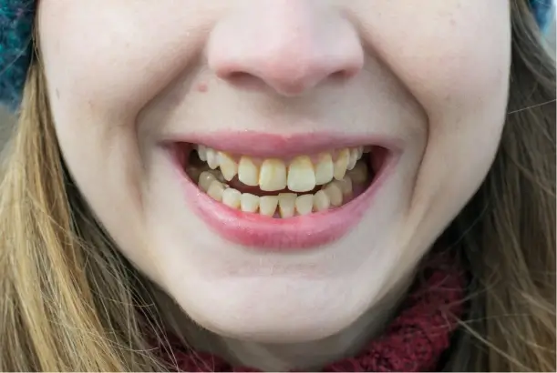 I Want to Have a Better Smile