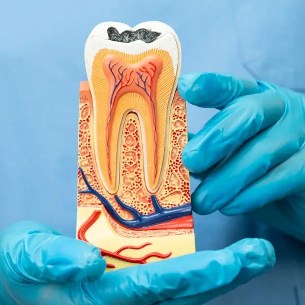 Root Canal Treatment Paddington
