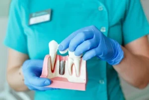 Dental Implant cost explanation