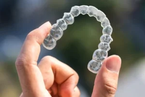 invisalign cost clear aligners